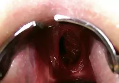 在屁股上受伤了